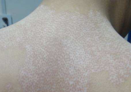 ݸưҽԺ 