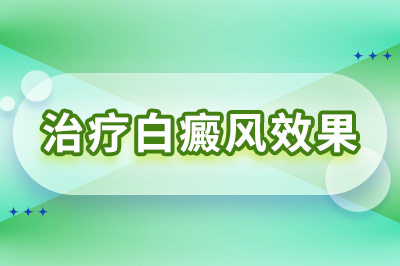 综߳ʲôͭ