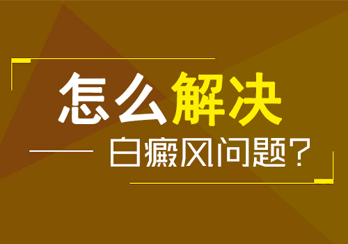 综Ҫעʲô
